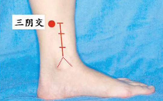 女性人流后肚子频繁疼痛需警惕严重可致不孕