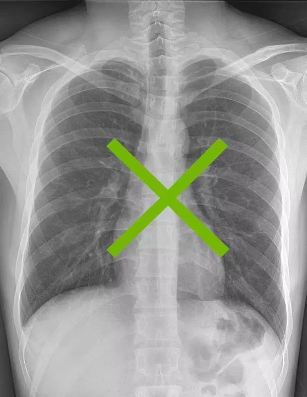 体检时做哪些准备必过,体检前一定要注意的10个细节