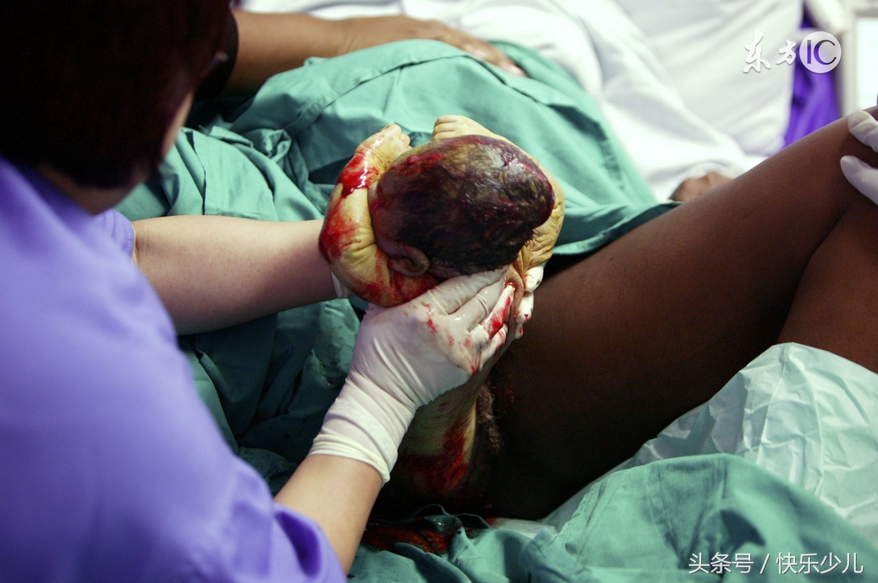 产妇（顺产）分娩的三个产程，以及顺产需要的时间