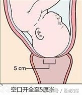 宫口开到十指到生需要多长时间,宫口开到十指是什么体验