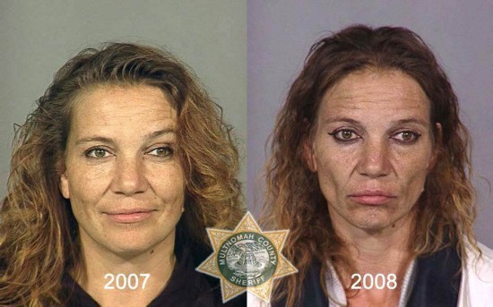 戒除毒瘾的最佳方法,怎么戒除毒瘾