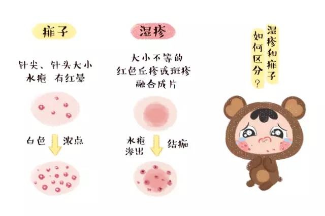 为什么不建议使用传统爽身粉,爽身粉使用心得