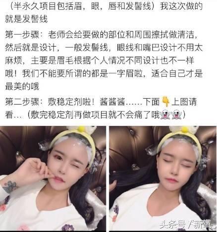 杨幂发际线还会回归吗,杨幂发际线秃到后脑勺