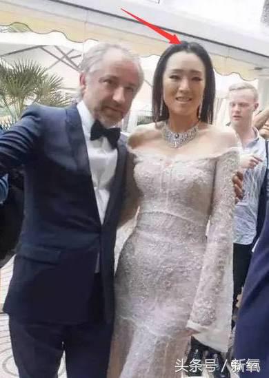 杨幂发际线还会回归吗,杨幂发际线秃到后脑勺