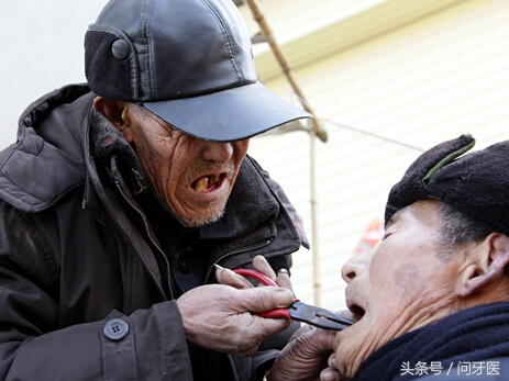 拔牙后为什么还一直流血,拔牙压迫止血后还一直流血