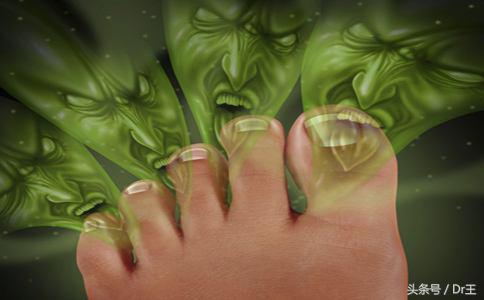 10招防脚臭,湿热天必备超实用!