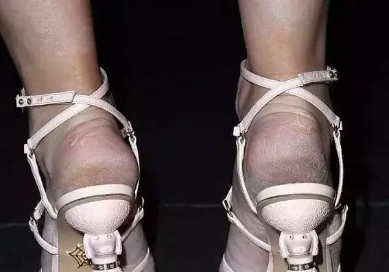 休闲鞋脚后跟磨脚小妙招,鞋子磨脚最简单的方法