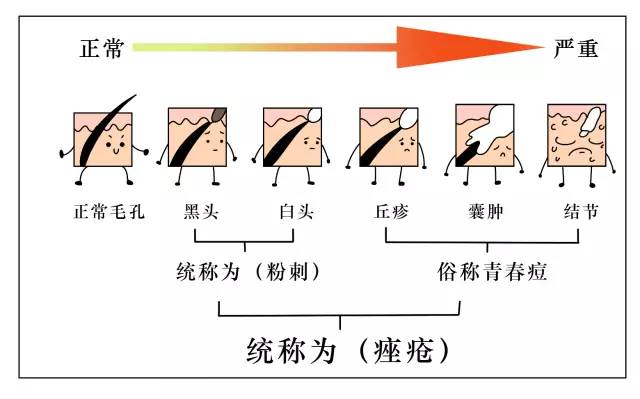 第二天要穿吊带如何解决背后痘痘,后背有痘痘穿吊带的急救办法