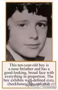用嘴呼吸的对容貌的影响,用嘴呼吸会导致什么面容