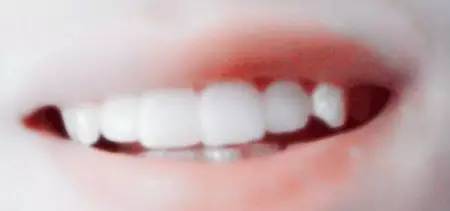 人怎么会长虎的牙齿,人为什么长牙会出血呢