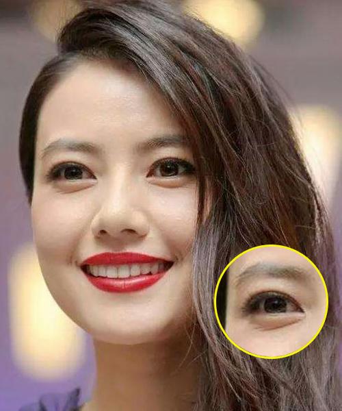 因为爱笑眼角皱纹比较多怎么办,爱笑的女孩有笑纹怎么办