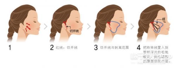 振动棒、腋下贴还送拉皮手术？奥斯卡大礼包脑洞可真大...