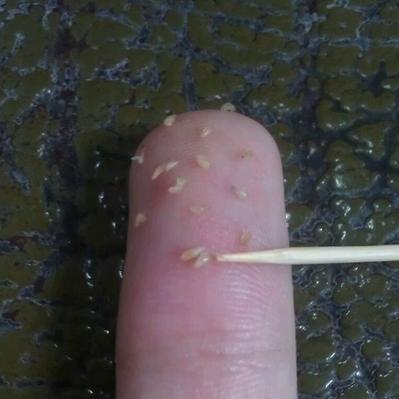 鼻子挤出的白色“条状物”是什么？要怎样才能将它们清理彻底！