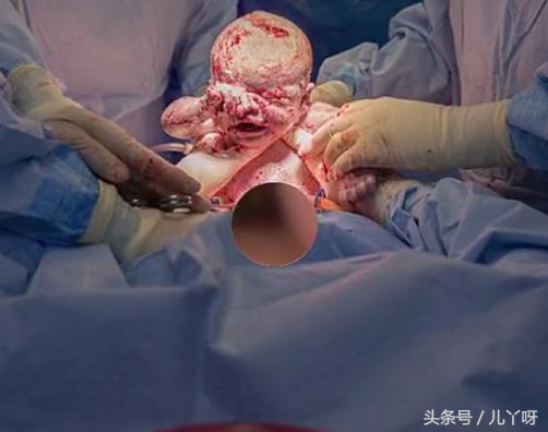 你生孩子痛的死去活来的时候，医生在做什么？