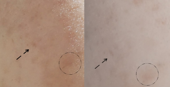 理肤泉k乳和duo乳可以一起用吗,理肤泉k乳对痘印有用吗