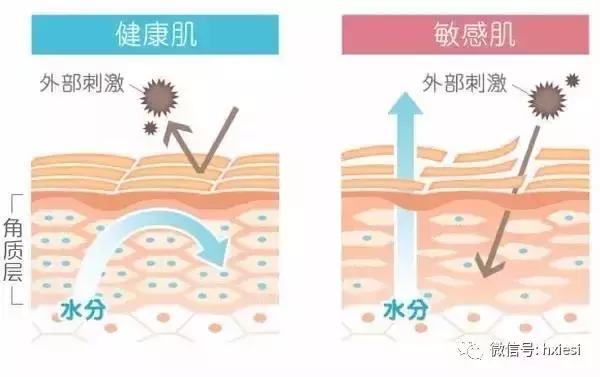 脸上红血丝去除的小妙招,去除脸上红血丝的最好方法