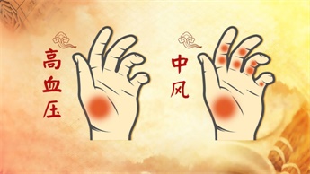 中医看手掌红判断疾病,中医怎么看手掌病