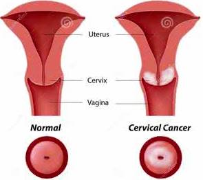 小颈,小颈的意思