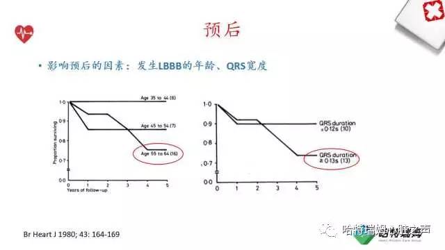 「心声」从机制到临床，一起认识左束支阻滞！