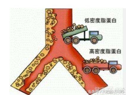 胆固醇和甘油三酯都高吃什么药物,甘油三酯高能吃他汀类的药物吗