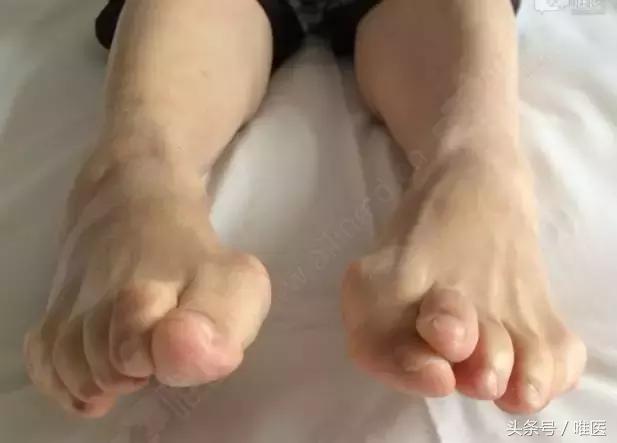 脚踝十年前扭伤现在肿痛什么原因,脚踝扭伤肿痛多少个小时可以擦药