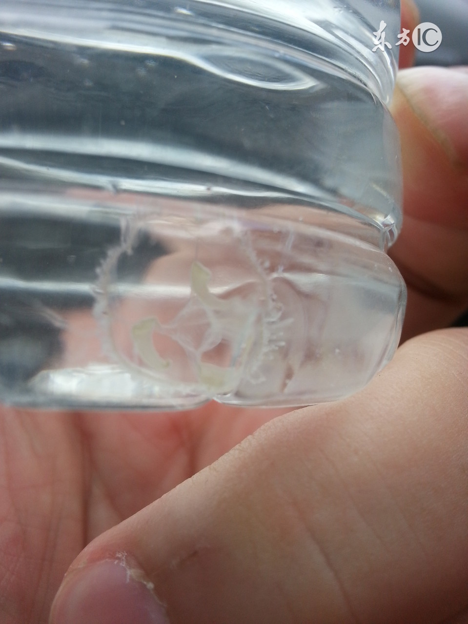 被水母蜇了怎么办小妙招,水母蜇人后抹什么药膏