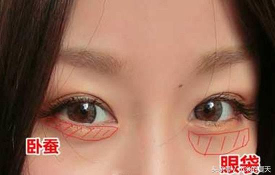 罗志祥眼袋是怎么形成的,罗志祥眼袋深度解析