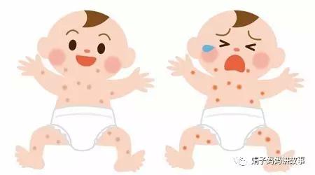 湿疹最简单的自愈方法孩子,在医院给孩子看湿疹的经历