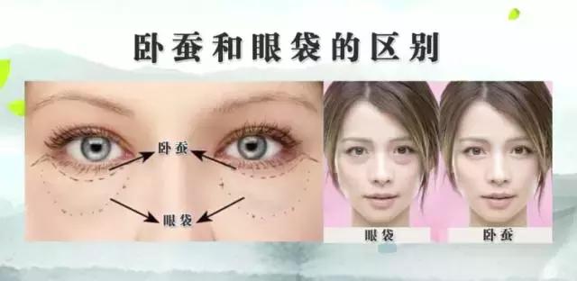 黑眼圈眼袋浮肿怎么回事,黑眼圈重卧蚕大肿眼泡什么原因