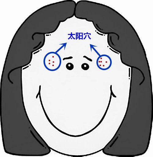 面部痘痘严重程度检测,痘痘面部分析