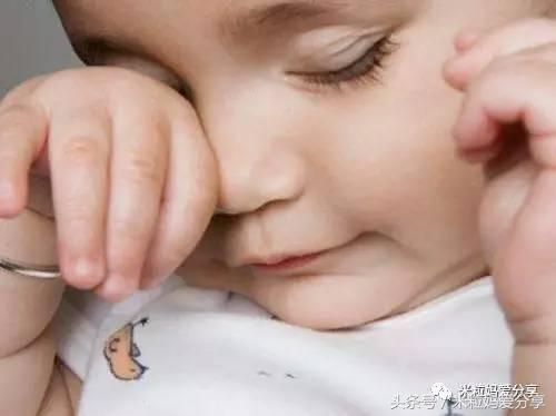 宝宝眼屎多便秘是怎么回事,宝宝眼屎多尿黄是怎么回事