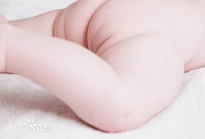 红屁屁的护理方法,纸尿裤红屁屁怎么护理