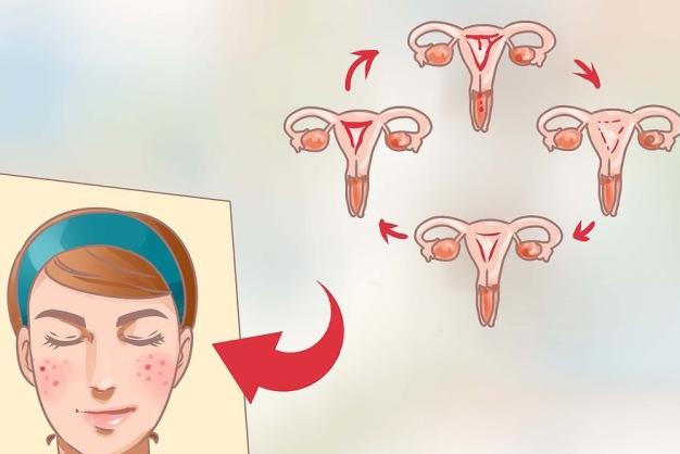 为啥生理期冒痘,经常长痘的原因和解决方法