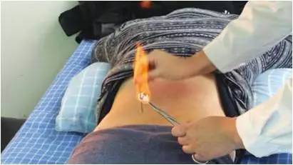 蛇串疮西医病名,蛇串疮医术专长综述范文