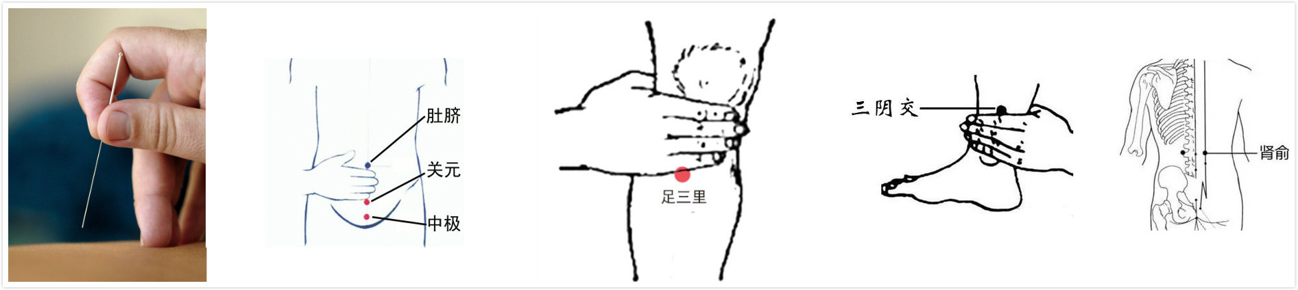 关注肾脏关爱女性健康,关注女性健康关爱自己