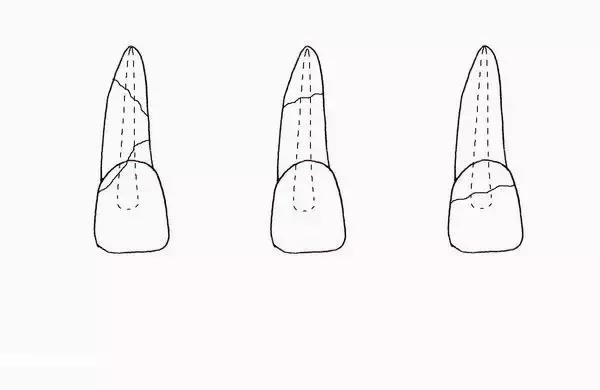 omg卡住了怎么回事,omg治疗