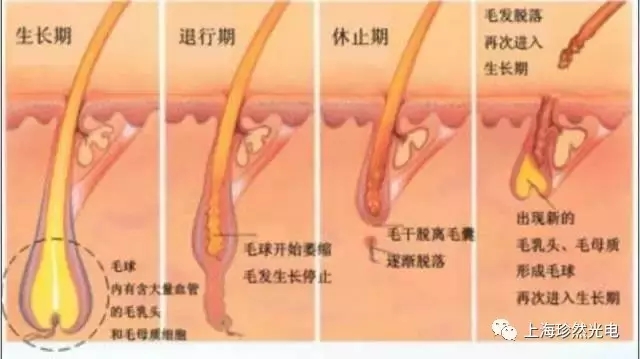 opt脱毛仪真的能脱干净吗,效果稳定opt脱毛仪