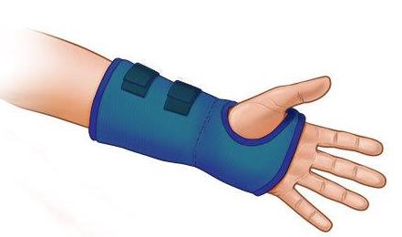 就医搜｜腕管综合征：容易在键盘上“敲”出的疾病！