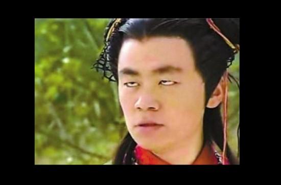 杨幂中医视频,杨幂针灸放血治疗