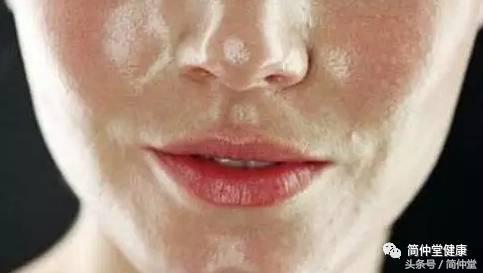 怎样控制脸上的油,脸上大油田怎样调理