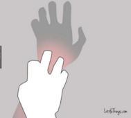 手臂上有针孔大小的红点正常吗,33岁女性手臂无缘无故有红点