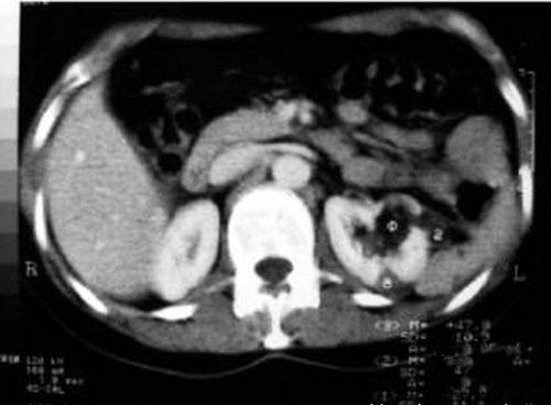 世界上比较诡异的人,世界上最诡异的十种人