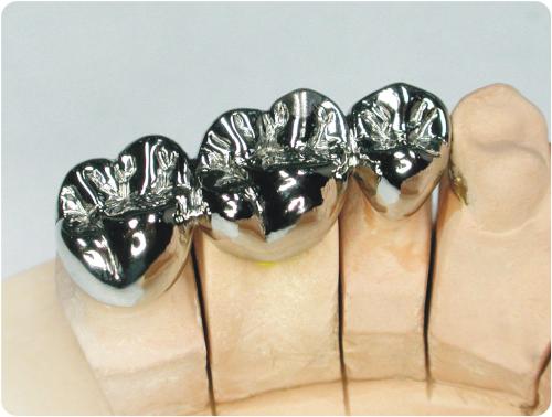 义齿怎么辨别真假,学会三招让你远离伪劣义齿