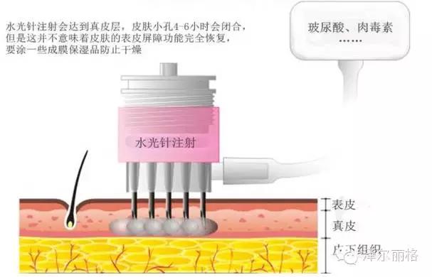 毛孔粗大收缩毛孔最有效的土方法,毛孔粗大怎么办教你快速收缩毛孔