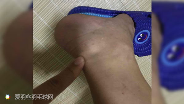 类风湿脚疼解决方法,80岁脚趾疼怎样治