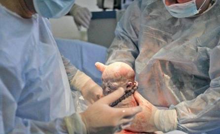 孕后期怎么样才知道要生了,孕后期应该知道的事