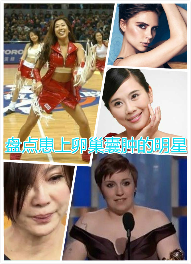 八卦盘点被报道过患上卵巢囊肿的明星