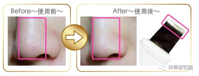 简单快速让皮肤水嫩的方式,怎么让皮肤像剥壳鸡蛋一样光滑