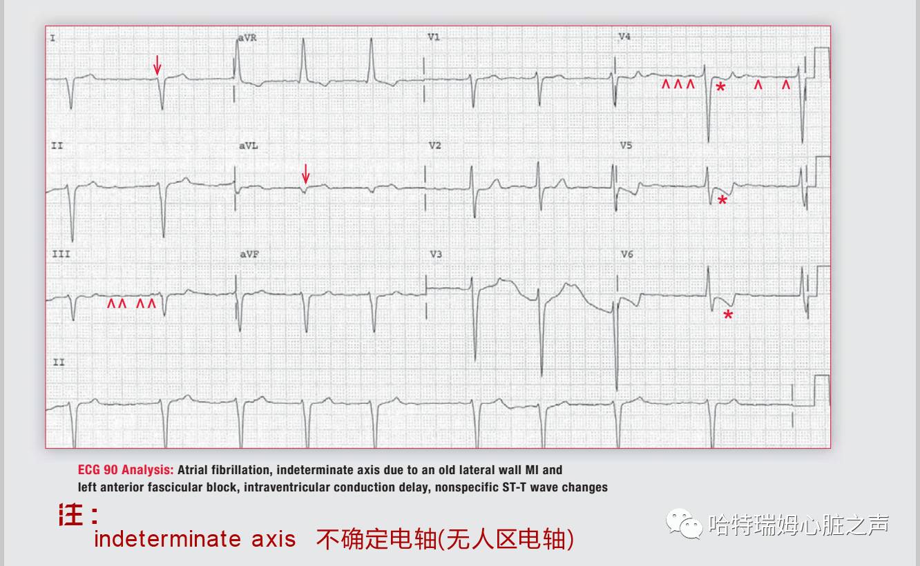 读心有术十二句话,读心有术2004
