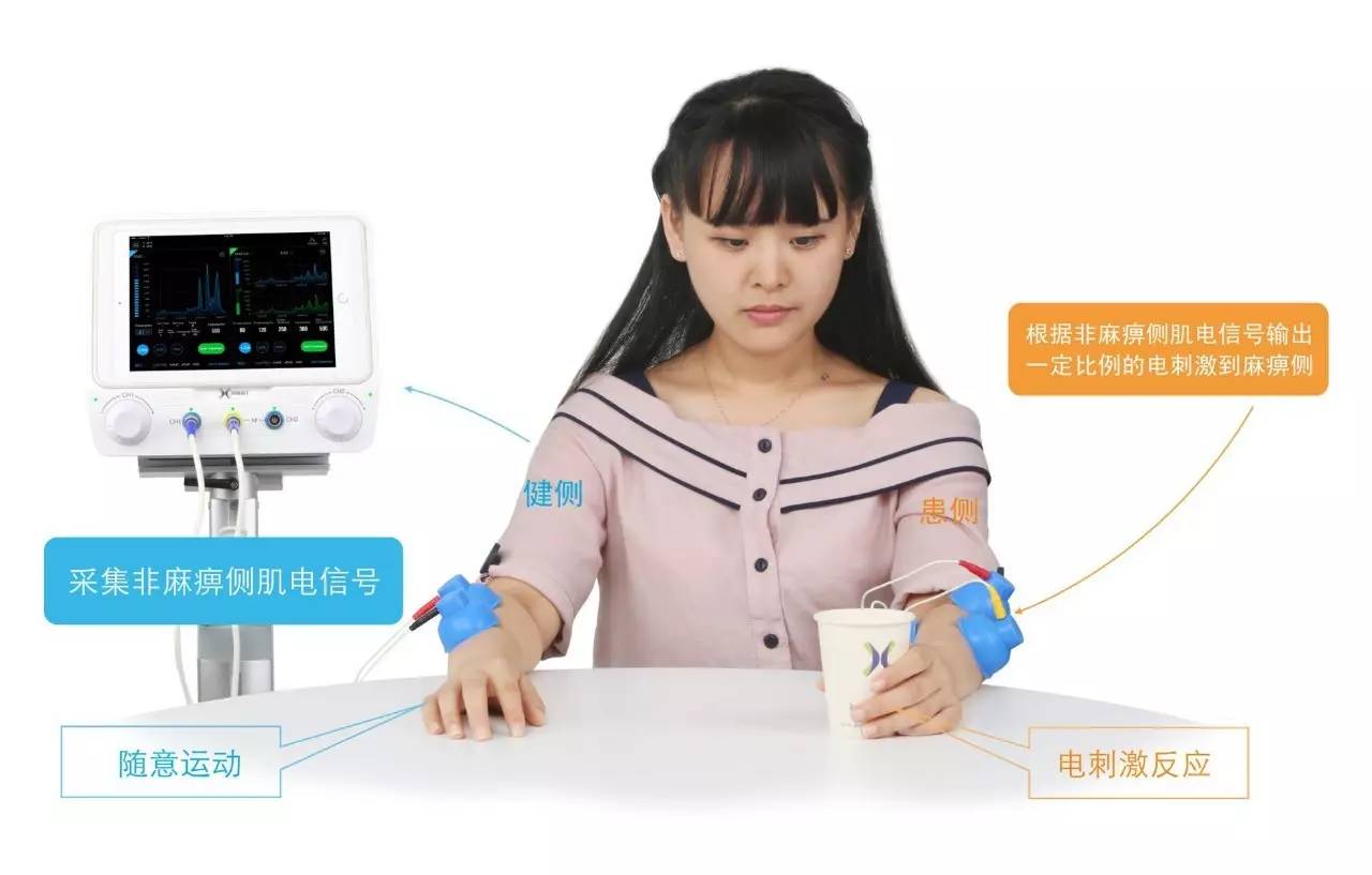 讯丰通xft肌电生物反馈仪,讯丰通第四代电刺激仪